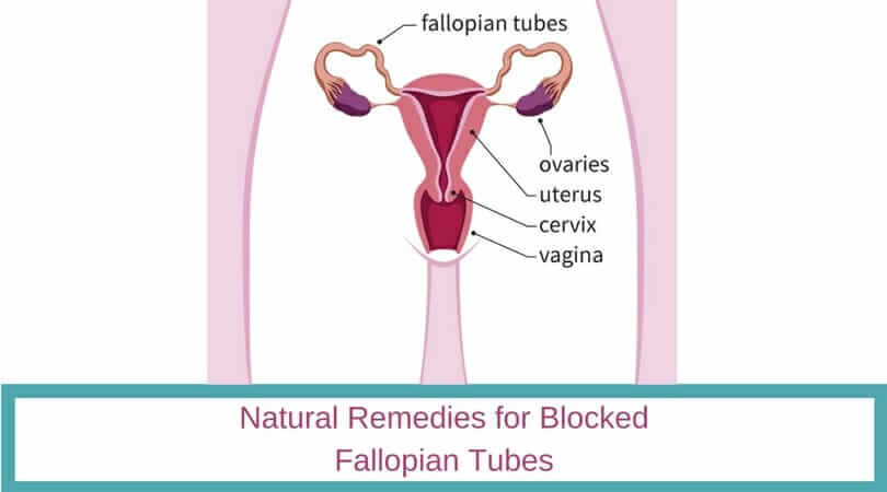 Natural Remedies for Blocked Fallopian Tubes