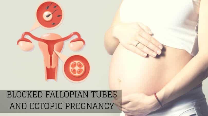 Blocked Fallopian Tubes and Ectopic Pregnancy