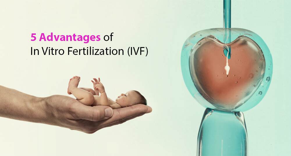 5 Advantages of In Vitro Fertilization (IVF)