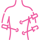 Laparoscopy