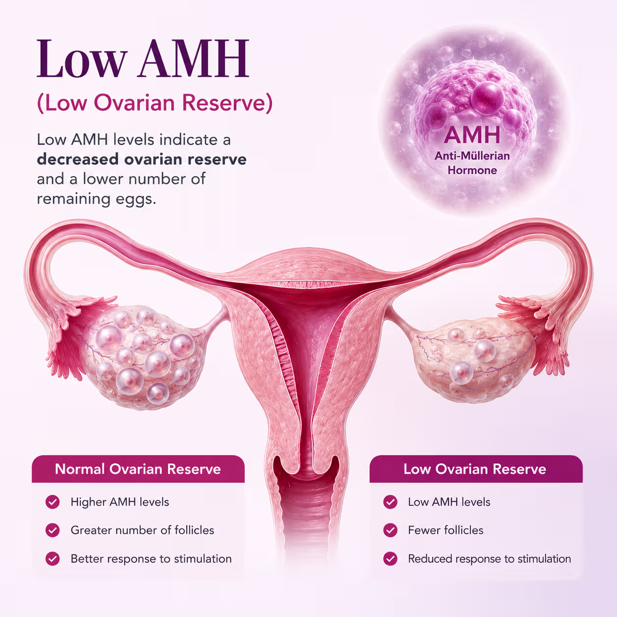 Low AMH follicle count chart showing poor ovarian reserve affecting female fertility - Wellspring IVF